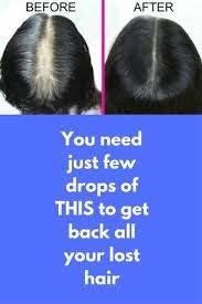 Pin By Tahir On Beauty Lost Hair Thick Hair Remedies Coconut Oil Hair Treatment
