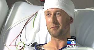 Comedian's skull cracked in onstage baseball bat attack by failed 'Jesus'  comic