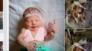 Herpes simplex virus (hsv) infections are ubiquitous and have a wide range of clinical manifestations (see the images below). 18 Day Old Baby Girl Dies After Contracting Meningitis Linked To Hsv 1 Parents Say Abc News