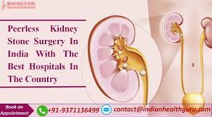 Peerless Kidney Stone Surgery In India With The Best Hospitals In The Country In 2020 Best Hospitals Kidney Stones Surgery