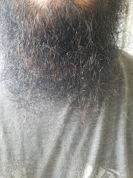To find out, just place the hair in sunlight and then look at the color, but you. I Naturally Have Black Hair But In My Beard There Are Lots Of Red Hairs Anyone Else Have Mixed Beard Colors Beards