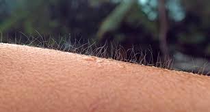We all know that it not only plays a vital role in the appearance of both men and women, but it also helps to transmit. Goose Bumps May Have Hairy Benefits Science News For Students