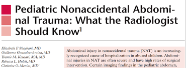 Image result for PECARN Pediatric Intra-Abdominal Injury Algorithm