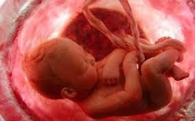 Check spelling or type a new query. Las Bacterias Transmitidas En El Utero Relacionadas Con Nacimiento Prematuro Y Distress Respiratorio El Medico Interactivo