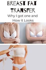 My Breast Fat Transfer Before And After Ancestral Nutrition