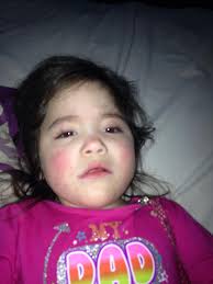 Child recovering and eating solid foods