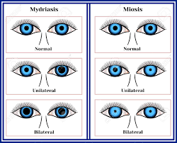 Mydriasis Expansion Of A Pupil And Miosis Narrowing Of A