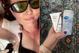 Braun ipl hair removal for women, silk expert pro 5 pl5137 with venus swirl razor. Laser Hair Removal Changed My Armpits And Got Rid Of My B O