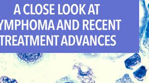 Burkitt lymphoma is considered the most aggressive form of lymphoma and is one of the fastest growing of all cancers. A Close Look At Lymphoma And Recent Treatment Advances Cancerconnect