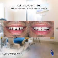 Lon clarke, to produce an . Aesthetic Dental Of Barbados Let S Fix Your Smile View Our Smile Gallery Of Before And After Dentistry Https Aestheticdental Bb Dental Smile Gallery At Aesthetic Dental We Pride Ourselves In Treating Our Patients With The Best