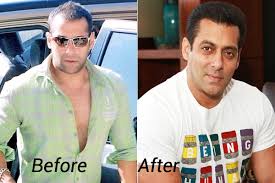 Additionally, hair loss is always a very bad news for any actor, especially if you are salman khan. Hair Loss Forum Bollywood Actor Salman Khan Hair Transplant Surgery