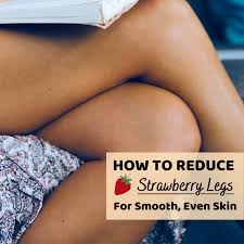 Excess vitamin a and selenium What Are Strawberry Legs And How Can You Get Rid Of Them Bellatory