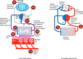 Image result for Delayed Transition from Fetal Circulation