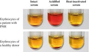 Image result for Ham Test