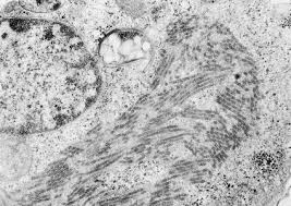 Image result for Filoviridae