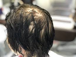 くせ毛 薄毛 髪型
