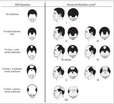 Pattern baldness is a genetic and hormonal condition with very specific characteristics and hair fall patterns. Is There A Link Between Baldness And Prostate Cancer