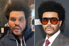 C3isulwsinhapm The weeknd, whose real name is abel tesfaye, revealed a dramatically altered face with exaggerated prosthetics that appeared to mimic severe.