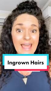 Effective Remedies for Treating Ingrown Hairs