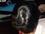 Healthy Crown Hair