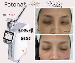 全球最頂尖皮秒、納秒、毫秒、微秒、Fotona超皮...