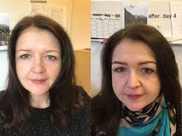 Microblading recommendations and negative experiences