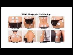 Tens Unit Placement Placement For Carpal Tunnel Arthritis