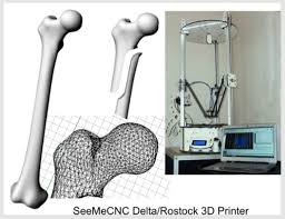 3. Huesos impresos en 3D