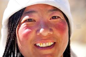 Browse 955 gold tooth stock photos and images available, or search for gold tooth smile to find more great stock photos and pictures. Portrait Of Tibetan Woman With Two Gold Teeth Stock Photo Offset