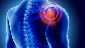 Lung cancer is one of the most common causes of mortality in males across the world. Pin On Pain