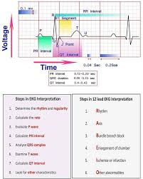 Learn Ecg Interpretation 10 Steps To Learn Ecg Interpretation Learning The Art Of Ecg Interpret Cardiac Nursing Ekg Interpretation Nursing School Prerequisites