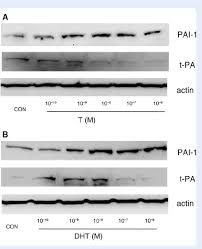 Check spelling or type a new query. Regulation Of Plasminogen Activator Inhibitor Pai 1 And T Pa By T And Download Scientific Diagram