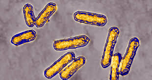 Headache, dizziness, pain in joints and muscles, confusion, stiff neck, seizures. What Is Listeria Facts You Need To Know