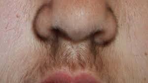 All women have body hair, but it may be more noticeable in some than in others and include growth on the face. Lanugo Causes And Treatment