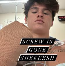 🚨INJURY UPDATE🚨 Haiden Deegan underwent surgery to remove a screw in his  wrist from his injury sustained before the 2024 SX season. (Via Haiden  Deegan/IG)