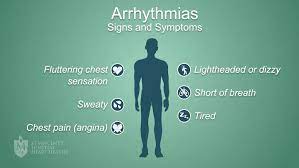 Arrhythmias St Vincent S Heart Health