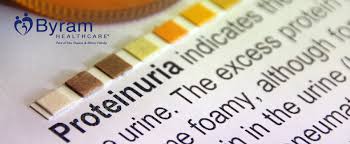 What Is Proteinuria And What Does It Mean