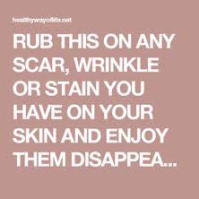 Bij ontstoken tandvlees en aantal bladeren salie in heet water doen en een flinke scheut zeezout erbij. 180 Ideeen Over Oma Weet Raad In 2021 Gezondheidstips Gezond Gezond Lichaam