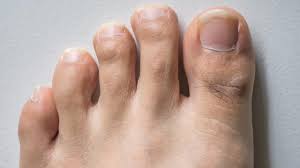 We've all got body hair (unless it's been lasered off) and yet so many people want to get rid of it. I M Getting Toe Hair As I Get Older Why Youtube