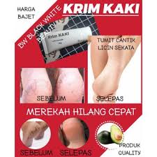 Plantar fasciitis adalah salah satu penyebab sakit tumit yang paling lazim. Krim Kaki Menawan Rawatan Tumit Kaki Merekah By Kosmetik Hanim Shopee Malaysia