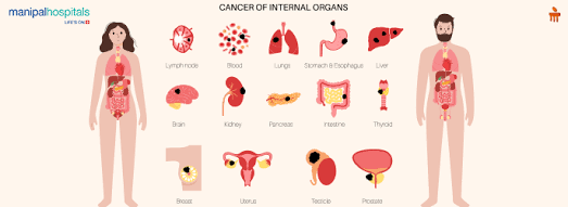 Cancer can affect various internal organs, and persistent pain in these regions warrants medical evaluation., AI generated