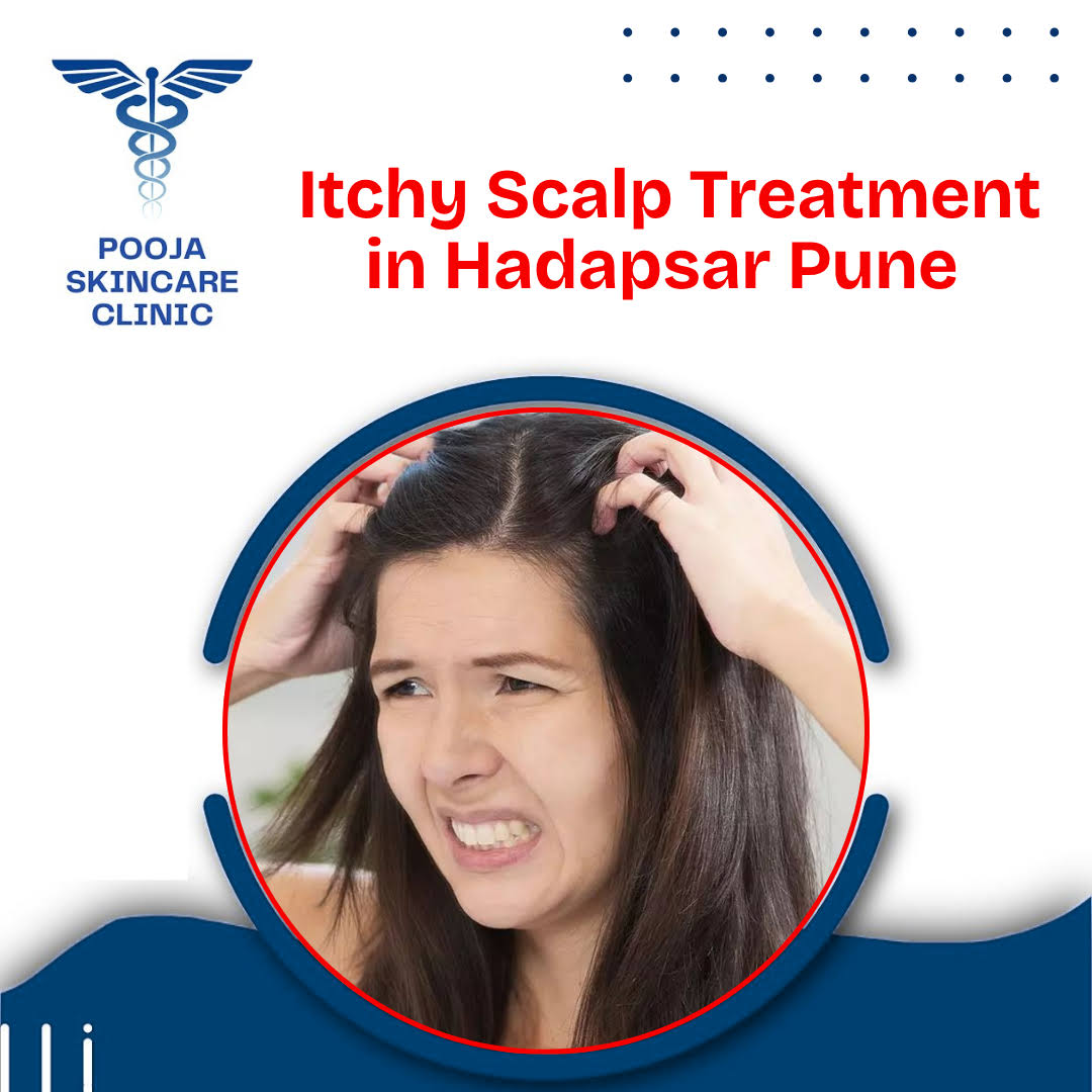 Itchy Scalp Treatment in Hadapsar Pune product image