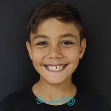 Paciente feliz con su tratamiento 😊. Presentaba un diente supernumerario,  un mesiodens, que no permitía la correcta alineación de uno de sus  centrales. Se realizó la extracción del mesiodens y luego se