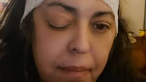 Fundraiser for Gail Hernandez-Muhilly by Peggy Bautista : Gail's 2nd Life  Saving Brain Surgery