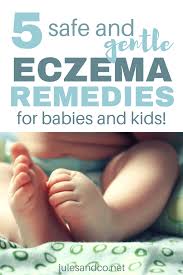 Into a bath of warm water, add two cups of apple cider vinegar. Baby Eczema Coconut Oil Treatment 4 More Natural Cures