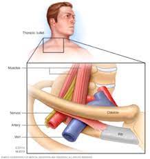 First Rib Resection For Thoracic Outlet Syndrome Vascular Care Centre