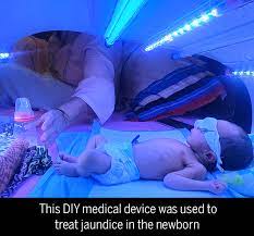 Maybe you would like to learn more about one of these? How A Diy Medical Device Saved This Newborn A Stint In Hospital Times Of India