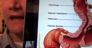 Pin On Diseases Conditions