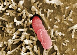 Image result for yersinia fotos