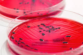 Salmonella enterica pure culture on blood agar. Salmonella Enterica Culture On Xld Agar Photograph By Daniela Beckmann